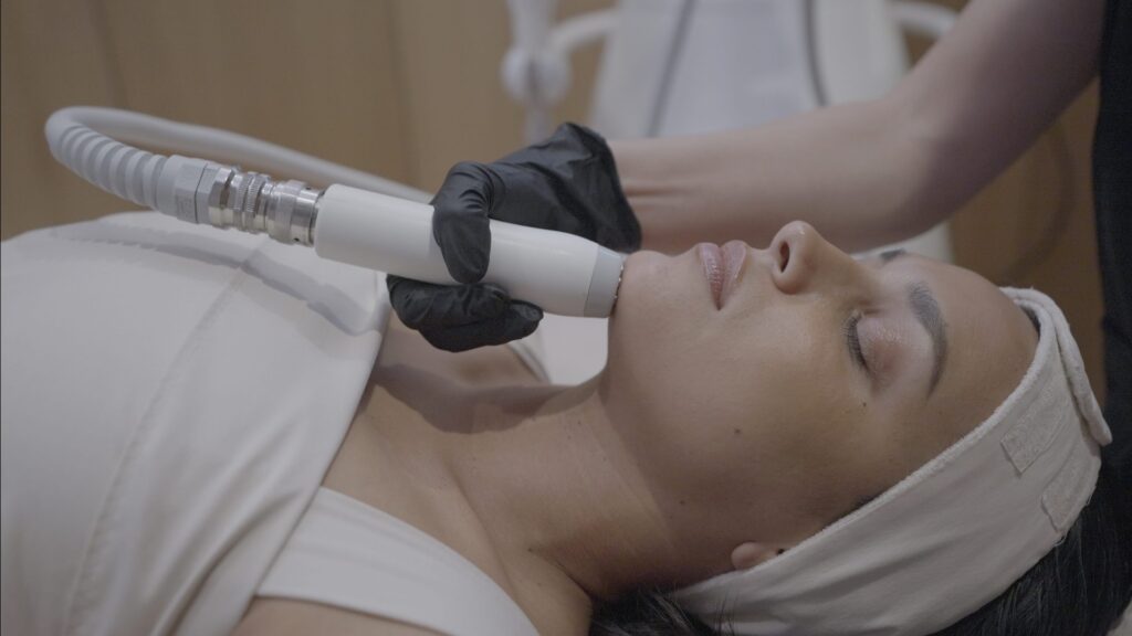 facial contouring treatment radiofrequency skin tightening